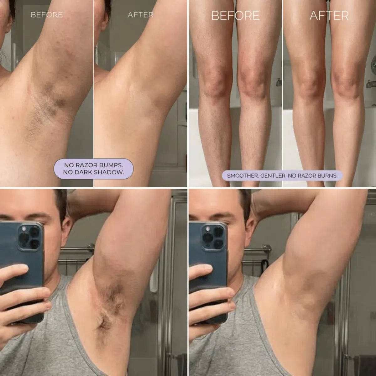 Hair Removal Mousse