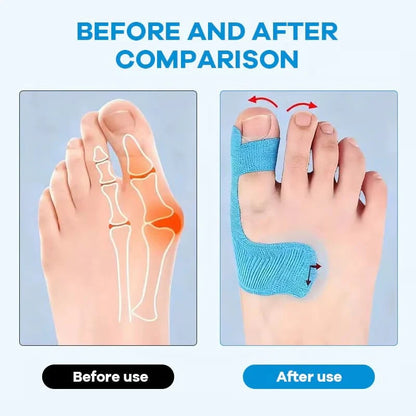 Toe Alignment Support Tape