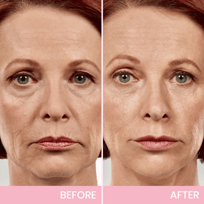 Invisible Face Lift Tape Patches