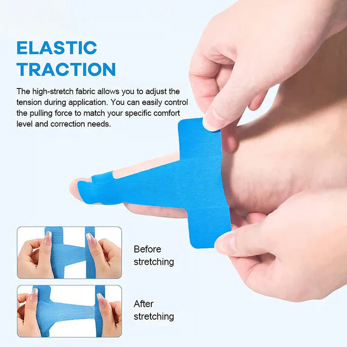 Toe Alignment Support Tape