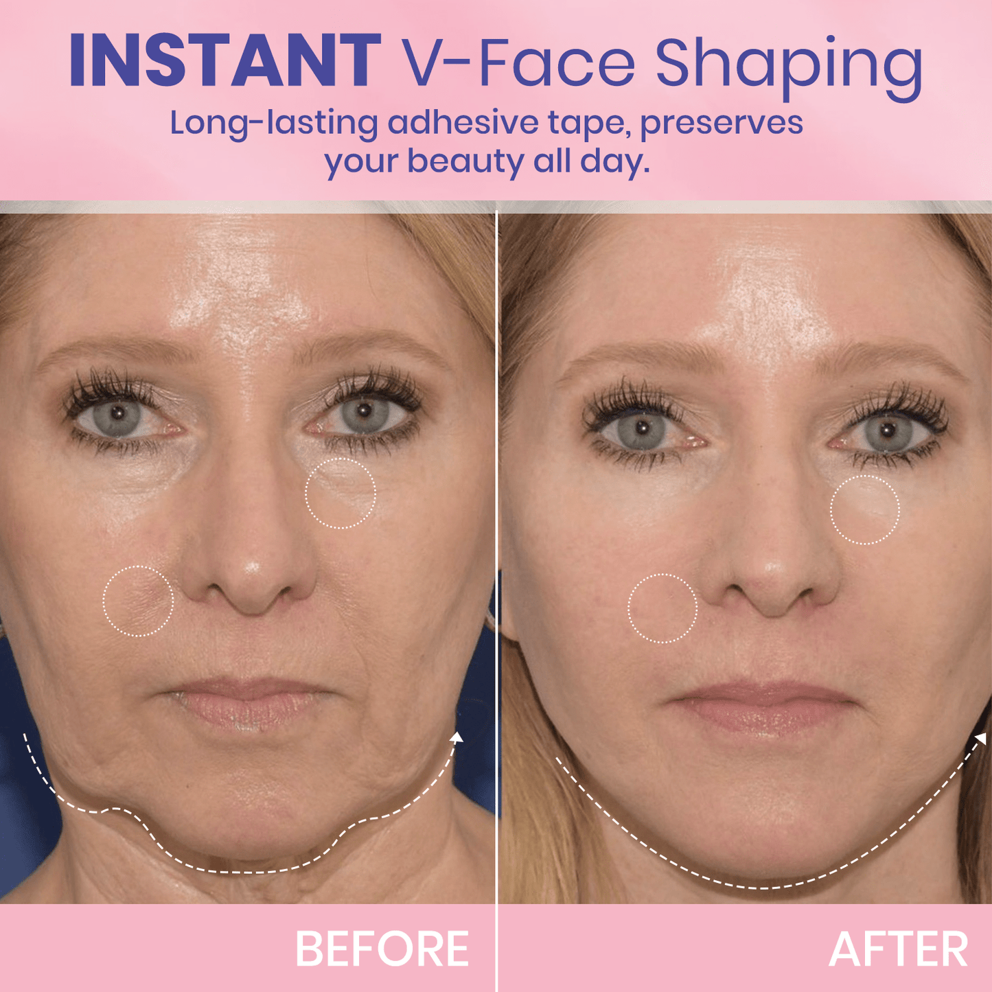 Invisible Face Lift Tape Patches