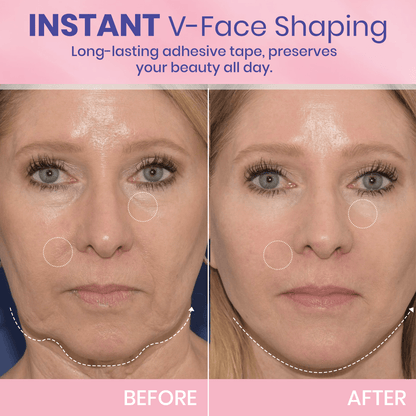 Invisible Face Lift Tape Patches